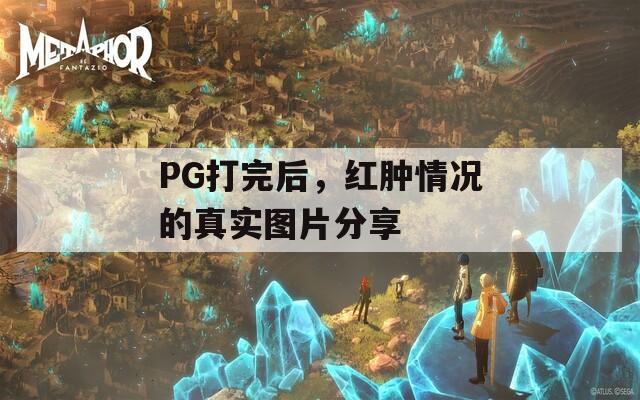 PG打完后，紅腫情況的真實圖片分享